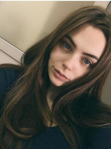 Альбина